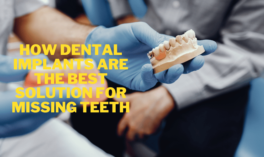 Advantages of Dental Implants